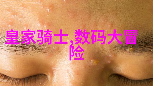 耐用之冠不锈钢材质的精选典范