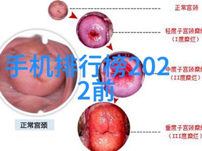 不锈钢管规格型号表精确选择合适的材料