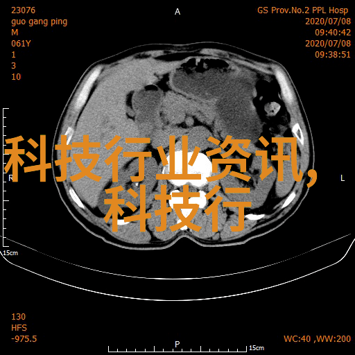 化肥破碎机的应用与维护秘诀