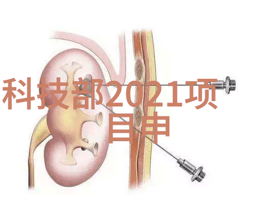 书房装修我是怎么把自己的小天地打造成最舒适的阅读角落