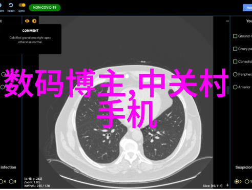 旋转分离的艺术连续离心过滤机的奇迹